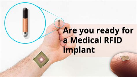 how to disable an implanted rfid chip|Microchip implant (human) .